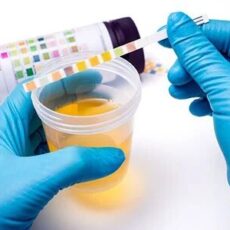 Urine Test